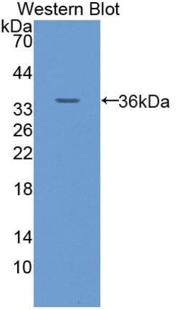 Invitrogen GLUT14 Polyclonal Antibody, Invitrogen 20 &mu;L | Buy Online | Invitrogen&trade; | Fisher Scientific