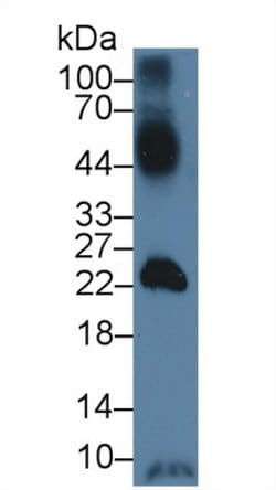 Invitrogen GLUT14 Polyclonal Antibody, Invitrogen 100 &mu;L; Unconjugated:Antibodies,