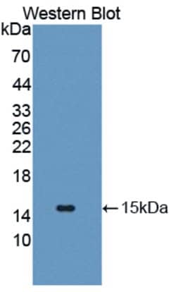 Invitrogen GLUT14 Polyclonal Antibody, Invitrogen 100 &mu;L; Unconjugated:Antibodies,