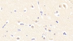 Invitrogen Gtf2h5 Polyclonal Antibody, Invitrogen:Antibodies:Primary Antibodies