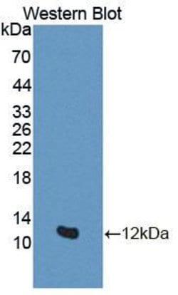 Invitrogen Gtf2h5 Polyclonal Antibody, Invitrogen:Antibodies:Primary Antibodies