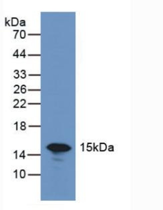 Galectin 7 Polyclonal Antibody, InvitrogenAntibodiesPrimary