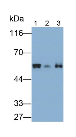 Invitrogen FSCN2 Polyclonal Antibody, Invitrogen 100 &mu;L; Unconjugated:Antibodies,