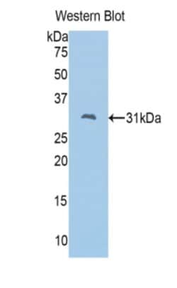 Invitrogen FSCN2 Polyclonal Antibody, Invitrogen 100 &mu;L; Unconjugated:Antibodies,