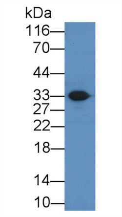 Invitrogen Ficolin 3 Polyclonal Antibody, Invitrogen 20 &mu;L; Unconjugated:Antibodies,