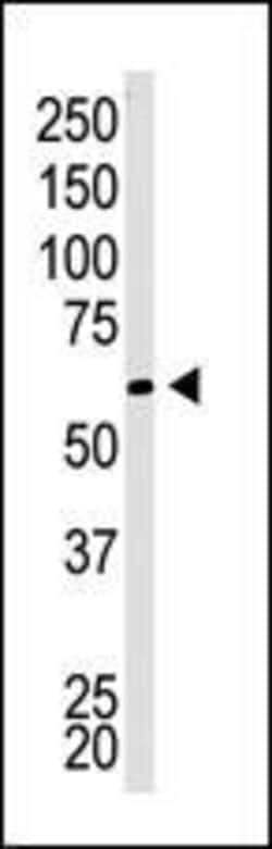 Invitrogen CBX4 Polyclonal Antibody 400 &mu;L; Unconjugated:Antibodies,