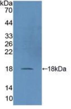 Invitrogen DUSP5 Polyclonal Antibody, Invitrogen 20 &mu;L; Unconjugated:Antibodies,
