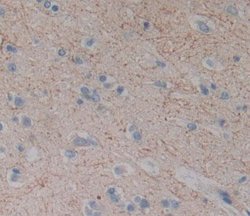 DLG5 Polyclonal Antibody, Invitrogen&trade;