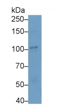 DLG5 Polyclonal Antibody, Invitrogen™