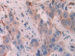 Invitrogen Cytokeratin 6C Polyclonal Antibody, Invitrogen 20 &mu;L; Unconjugated:Antibodies,