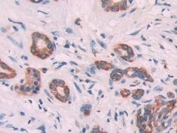 Invitrogen Cytokeratin 6C Polyclonal Antibody, Invitrogen 20 &mu;L; Unconjugated:Antibodies,