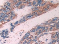Invitrogen Cytokeratin 6C Polyclonal Antibody, Invitrogen 20 &mu;L; Unconjugated:Antibodies,
