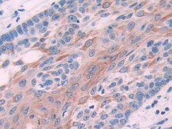 Invitrogen Cytokeratin 6C Polyclonal Antibody, Invitrogen 20 &mu;L; Unconjugated:Antibodies,