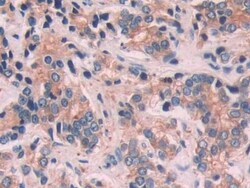 Invitrogen Cytokeratin 6C Polyclonal Antibody, Invitrogen 20 &mu;L; Unconjugated:Antibodies,