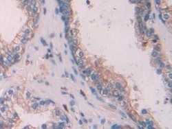 Invitrogen Cytokeratin 6C Polyclonal Antibody, Invitrogen 20 &mu;L; Unconjugated:Antibodies,