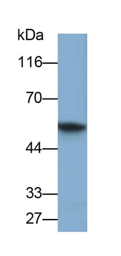 Invitrogen Cytokeratin 6C Polyclonal Antibody, Invitrogen 20 &mu;L; Unconjugated:Antibodies,