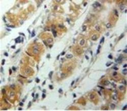 CXCL17 Polyclonal Antibody, Invitrogen:Antibodies:Primary Antibodies