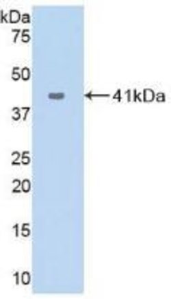 CXCL17 Polyclonal Antibody, Invitrogen:Antibodies:Primary Antibodies