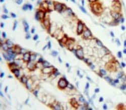 c-Mpl Polyclonal Antibody, Invitrogen:Antibodies:Primary Antibodies