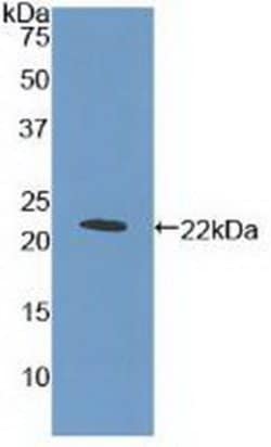 Invitrogen c-Mpl Polyclonal Antibody, Invitrogen 20 &mu;L; Unconjugated:Antibodies,