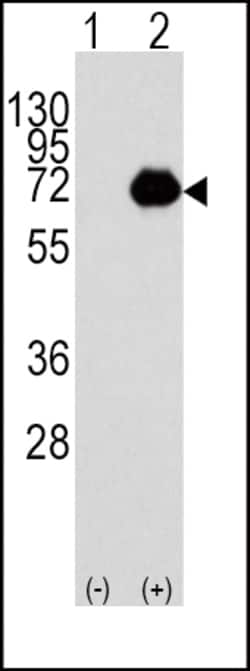 Invitrogen ACOX1 Polyclonal Antibody 400 μL; Unconjugated:Antibodies,