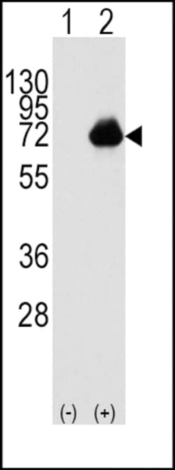 Invitrogen ACOX1 Polyclonal Antibody 400 μL; Unconjugated:Antibodies,