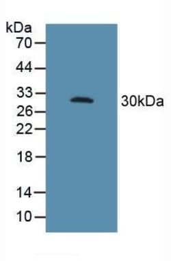 Invitrogen CD16 Polyclonal Antibody, Invitrogen:Anticorps:Anticorps primaires