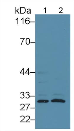 Invitrogen CD16 Polyclonal Antibody, Invitrogen 20 &mu;L; Unconjugated:Anticorps,