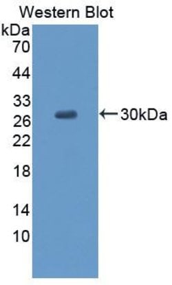 Invitrogen CCDC3 Polyclonal Antibody, Invitrogen 20 &mu;L | Buy Online | Invitrogen&trade; | Fisher Scientific