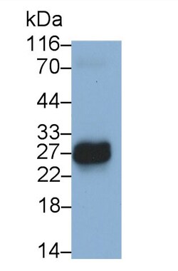 Invitrogen CCDC3 Polyclonal Antibody, Invitrogen 20 &mu;L | Buy Online | Invitrogen&trade; | Fisher Scientific