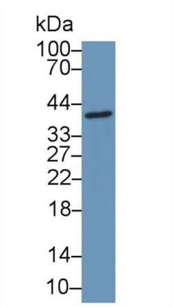 Invitrogen CCDC3 Polyclonal Antibody, Invitrogen 20 &mu;L | Buy Online | Invitrogen&trade; | Fisher Scientific
