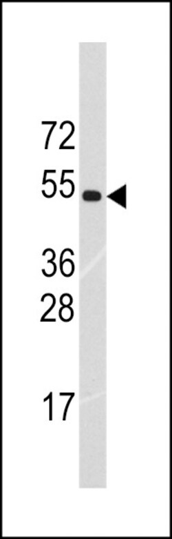 Invitrogen RNF36 Polyclonal Antibody 400 &mu;L; Unconjugated:Antibodies,