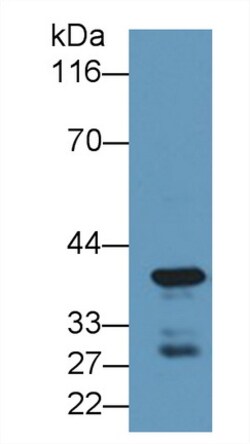 Invitrogen Carboxypeptidase A4 Polyclonal Antibody, Invitrogen 20 &mu;L | Buy Online | Invitrogen&trade; | Fisher Scientific