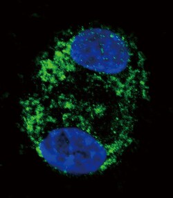 Invitrogen CPT2 Polyclonal Antibody 400 &mu;L; Unconjugated:Antibodies,