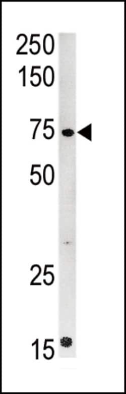 Invitrogen CPT2 Polyclonal Antibody 400 &mu;L; Unconjugated:Antibodies,