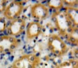 Invitrogen Complement C4a Polyclonal Antibody, Invitrogen 20 &mu;L; Unconjugated:Antibodies,