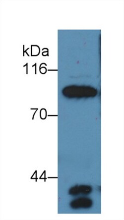 Invitrogen Complement C4a Polyclonal Antibody, Invitrogen 20 &mu;L; Unconjugated:Antibodies,
