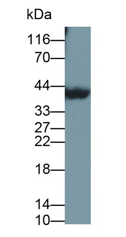 Invitrogen beta L Crystallin Polyclonal Antibody, Invitrogen 20 &mu;L | Buy Online | Invitrogen&trade; | Fisher Scientific