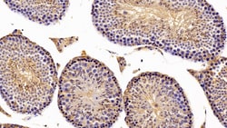 Invitrogen BCMO1 Polyclonal Antibody, Invitrogen 20 &mu;L; Unconjugated:Antibodies,