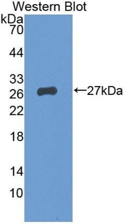 Invitrogen BCMO1 Polyclonal Antibody, Invitrogen 20 &mu;L; Unconjugated:Antibodies,