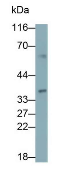 Invitrogen BCMO1 Polyclonal Antibody, Invitrogen 20 &mu;L; Unconjugated:Antibodies,