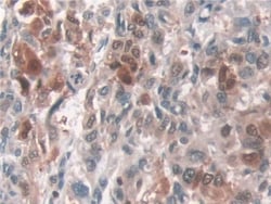 Invitrogen ATP7B Polyclonal Antibody, Invitrogen 100 &mu;L; Unconjugated:Antibodies,