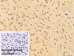 Invitrogen ATP7B Polyclonal Antibody, Invitrogen 100 &mu;L; Unconjugated:Antibodies,