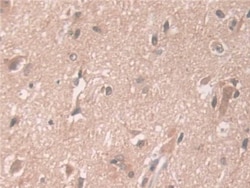 Invitrogen ATP7B Polyclonal Antibody, Invitrogen 100 &mu;L; Unconjugated:Antibodies,
