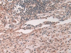 Invitrogen ATP7B Polyclonal Antibody, Invitrogen 100 &mu;L; Unconjugated:Antibodies,