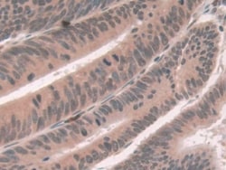 Invitrogen ATP7B Polyclonal Antibody, Invitrogen 100 &mu;L; Unconjugated:Antibodies,