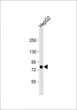 Invitrogen ACSL4 Polyclonal Antibody 400 &mu;L; Unconjugated:Antibodies,