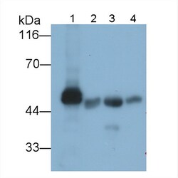 Invitrogen Amylase alpha Polyclonal Antibody, Invitrogen 100 &mu;L | Buy Online | Invitrogen&trade; | Fisher Scientific