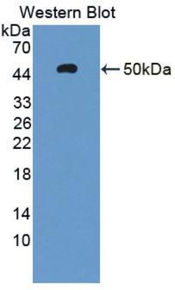 Invitrogen AHRR Polyclonal Antibody, Invitrogen 100 &mu;L; Unconjugated:Antibodies,