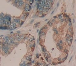 ADAMTS16 Polyclonal Antibody, Invitrogen 100 &mu;L; Unconjugated:Antibodies,
